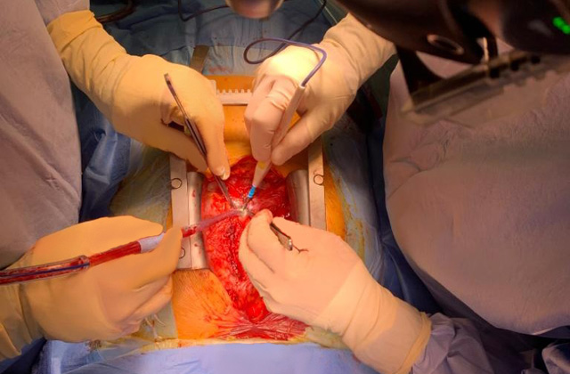 В Центре Алмазова врачи спасли молодую женщину с крайне редкой кардиологической патологией