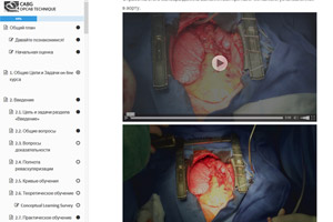 Онлайн курс обучения хирургии коронарных артерий без искусственного кровообращения