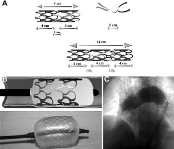 Djumbodis Dissecction System