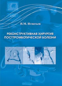 Вышла в свет монография И.М. Игнатьева «Реконструктивная хирургия посттромботической болезни»