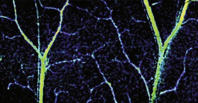 Новая технология позволила детально рассмотреть человеческие капилляры изнутри