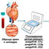 Ишемическую болезнь сердца научились диагностировать по анализу крови