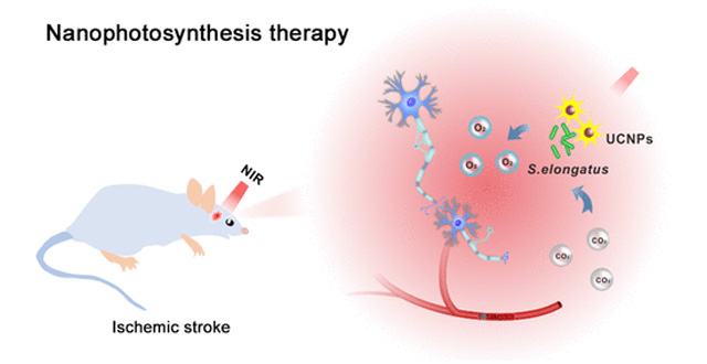 Ученые создали наночастицы, снабжающие клетки мозга кислородом после инсульта