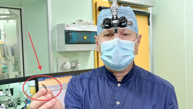 Кардиохирурги госпиталя Вишневского извлекли из сердца военнослужащего трехсантиметровый осколок